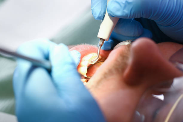 Best Root Canal Emergency Dentist  in Delavan Lake, WI