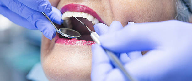 Best Chipped Tooth Repair Near Me  in Delavan Lake, WI